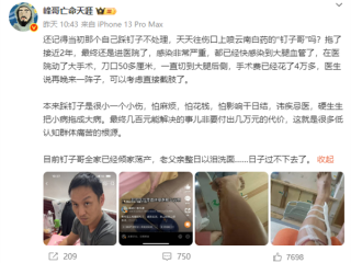 男子2年前踩钉子未就医 只用自来水洗伤口喷药：面临截肢风险！ 