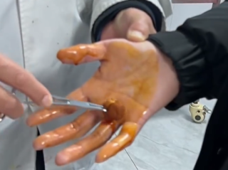 男子徒手摸灭火毯双手被刺钻心疼：主体材质玻璃纤维 需握黑色拉带 ！