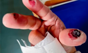 女子误踩身亡！警惕清洁剂中隐藏的“化骨水” 你家可能也有 !