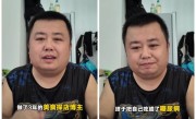 美食博主探店3年确诊糖尿病：开始减肥送外卖 !