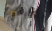 刚买一个月的充电宝突然自燃 17岁高中生校服被烧出大洞 !