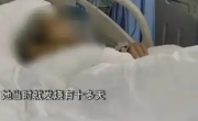 女子遛娃回来发烧十多天确诊恙虫病：脏器损害 错过治疗窗口期 ！