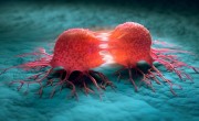 科学家用震动杀死癌细胞 命中率接近100% ！
